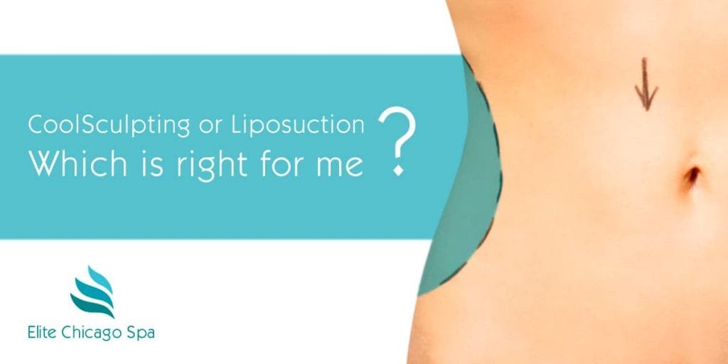 coolsculpting vs liposuction