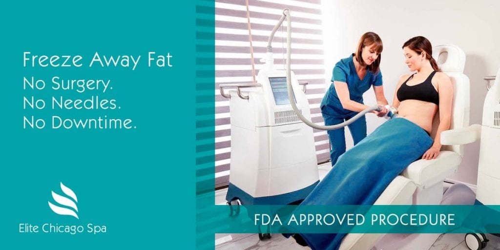 Is CoolSculpting a safe procedure for fat reduction