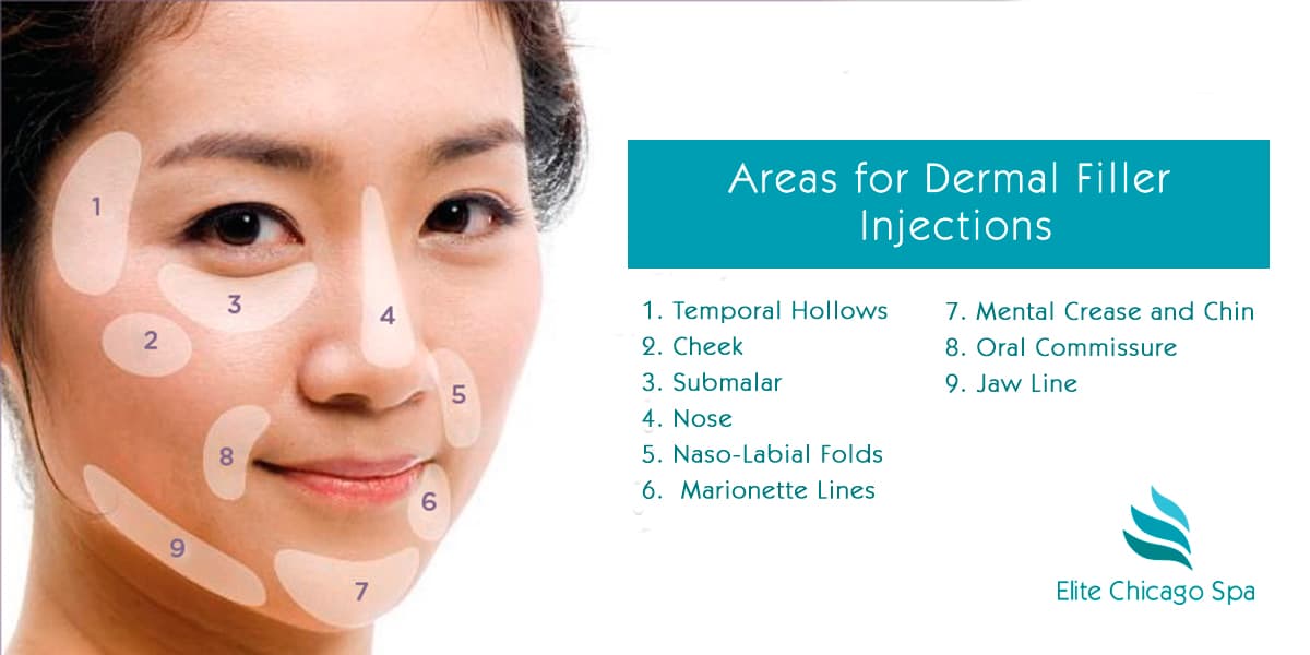 What are dermal fillers? Benefits And effects