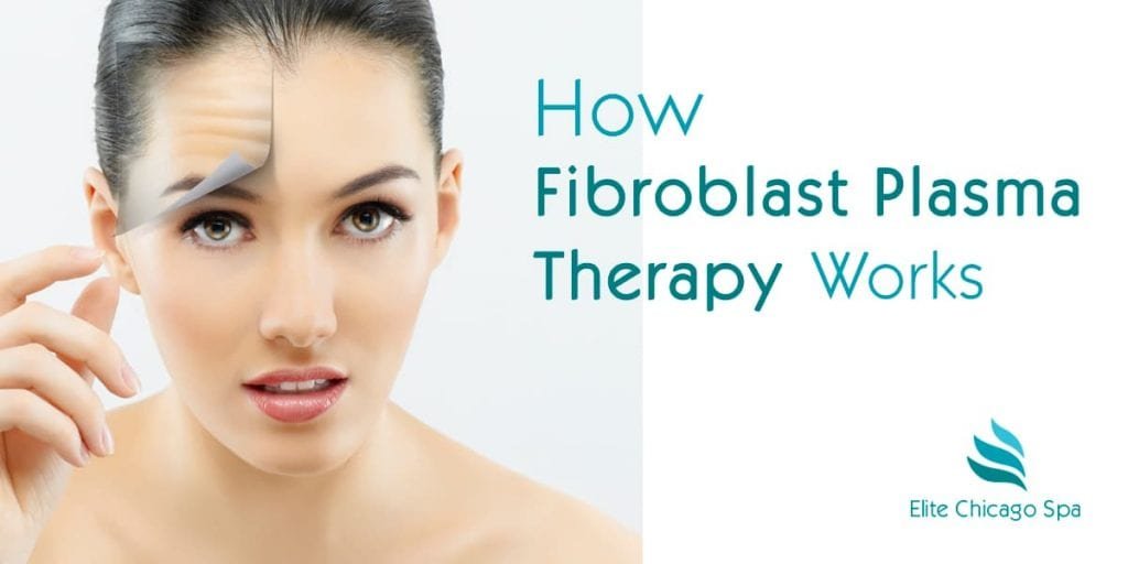 What is plasma pen fibroblast therapy