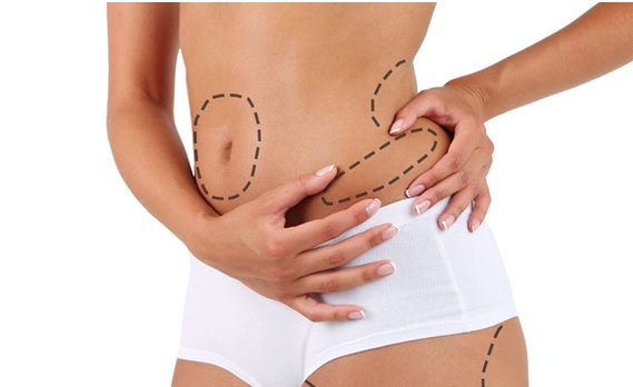 Coolsculpting for fat removal