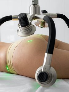 What are the Risks of Laser Fat Removal