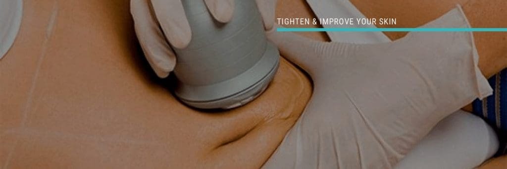 what are the side effects of ultrasonic cavitation