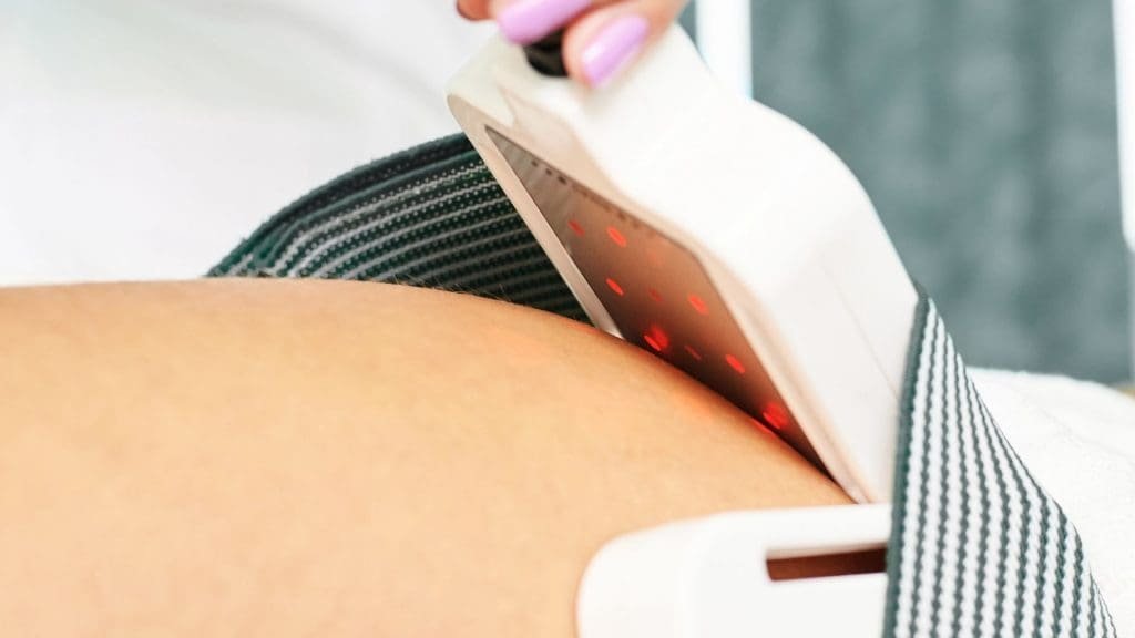 What is laser liposuction