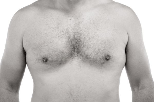 laser hair removal in chicago for chest hair