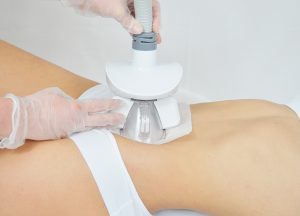 CoolSculpting vs Cryopolisis: Everything you Need to Know