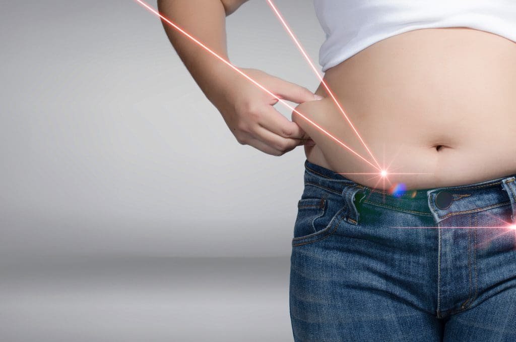 What you should know before having laser liposuction