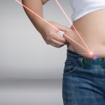 What you Should Know Before Having Laser Liposuction