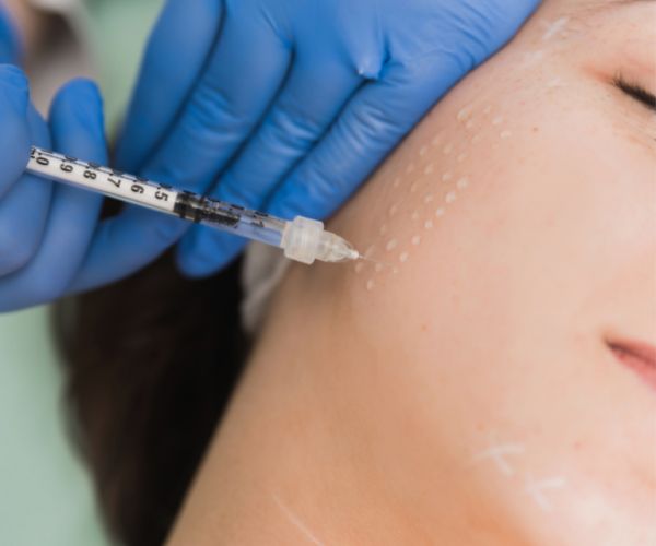 mesotherapy injections