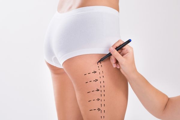 risks of laser liposuction