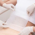 What Is The Difference Between Coolsculpting And Cryolipolysis?