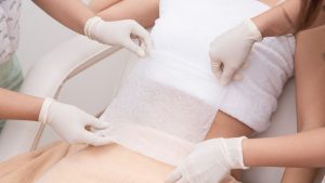 What Is The Difference Between Coolsculpting And Cryolipolysis?