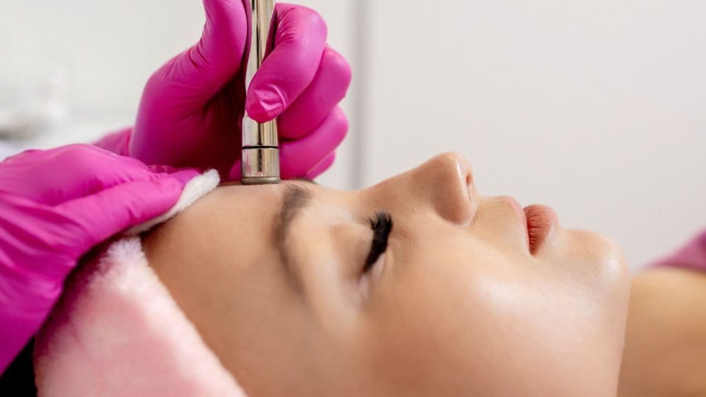 microdermabrasion