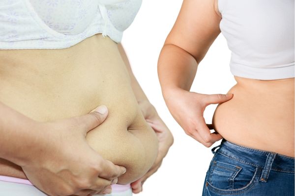 soft fat is a type of corporal fat