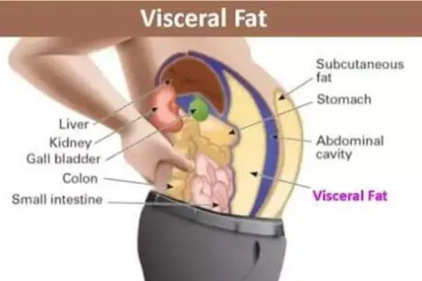 visceral type of body fat