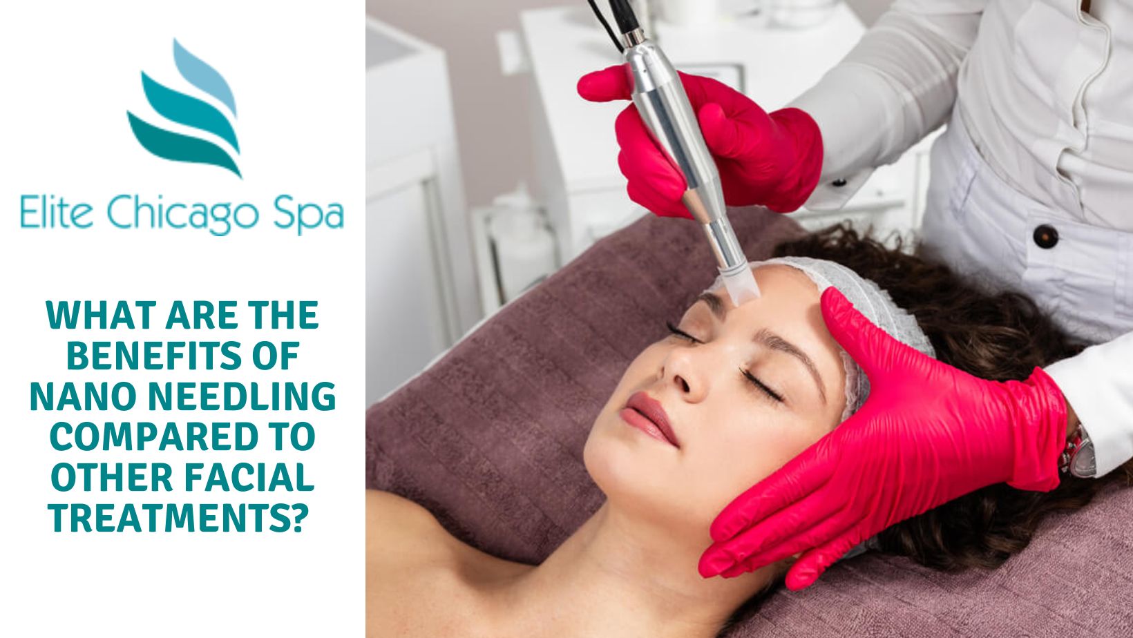 Read more about the article What Are The Benefits Of Nano Needling Compared To Other Facial Treatments?