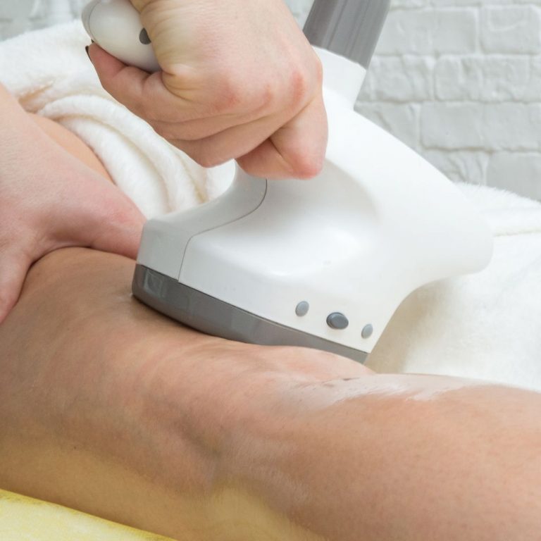 Cellulite Removal Chicago