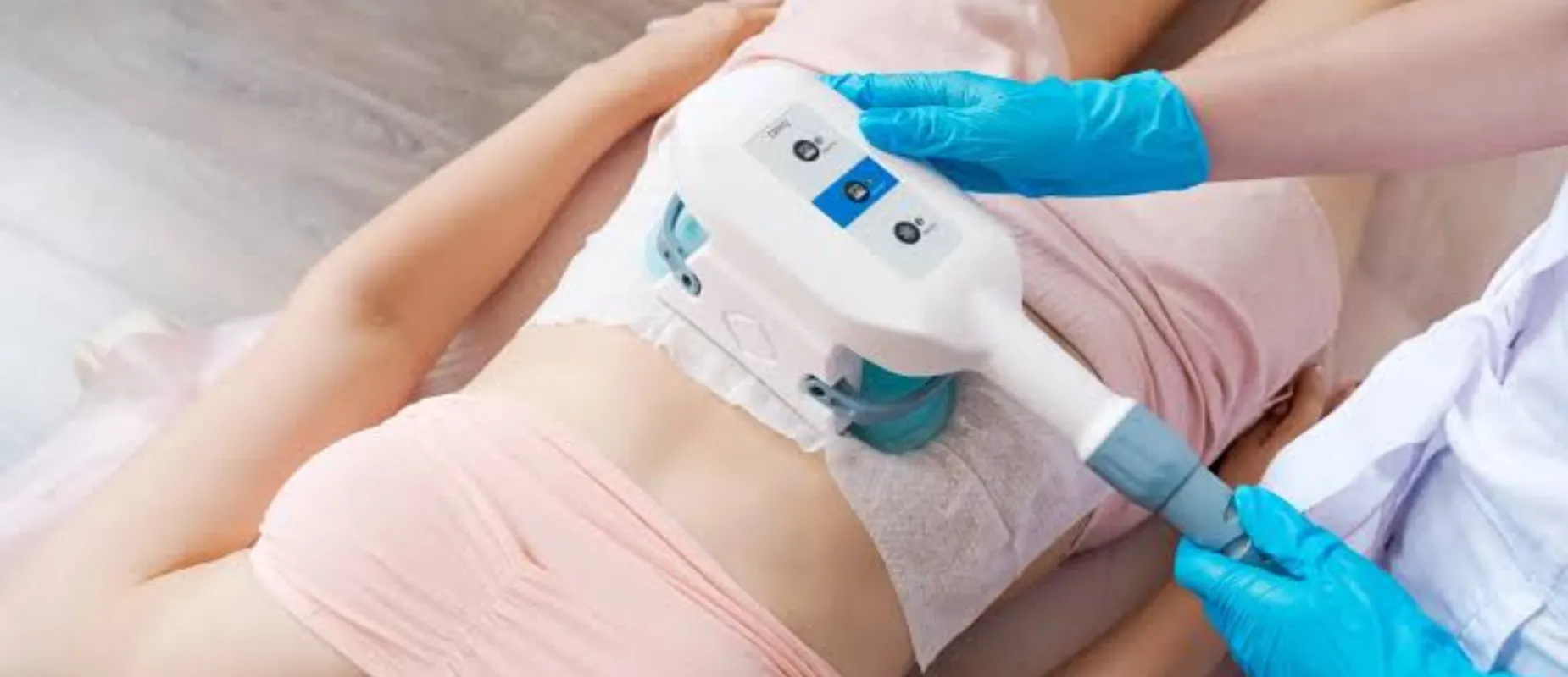 How Much Fat Does CoolSculpting Reduce Per Session?