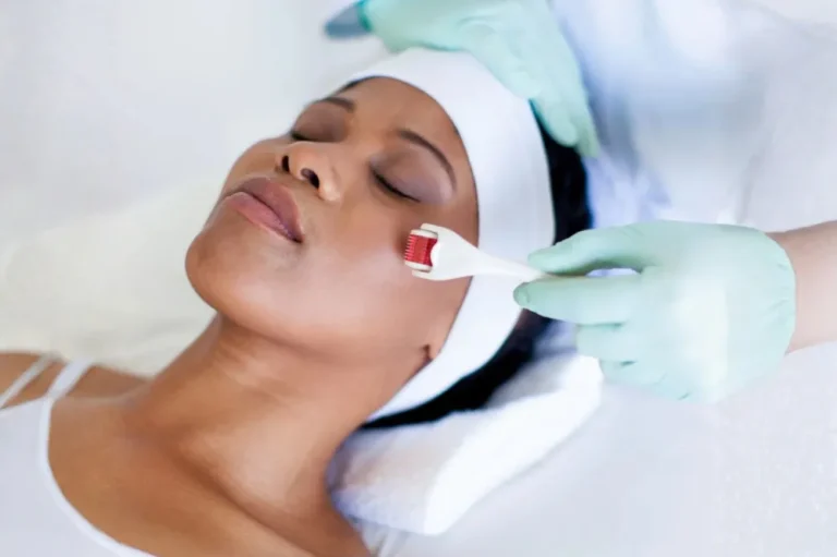 Thread lift procedure and aftercare